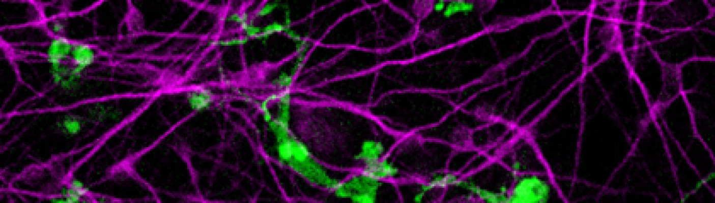 Mikrogliale Zellen | Bildquelle: NMI Universität Tübingen